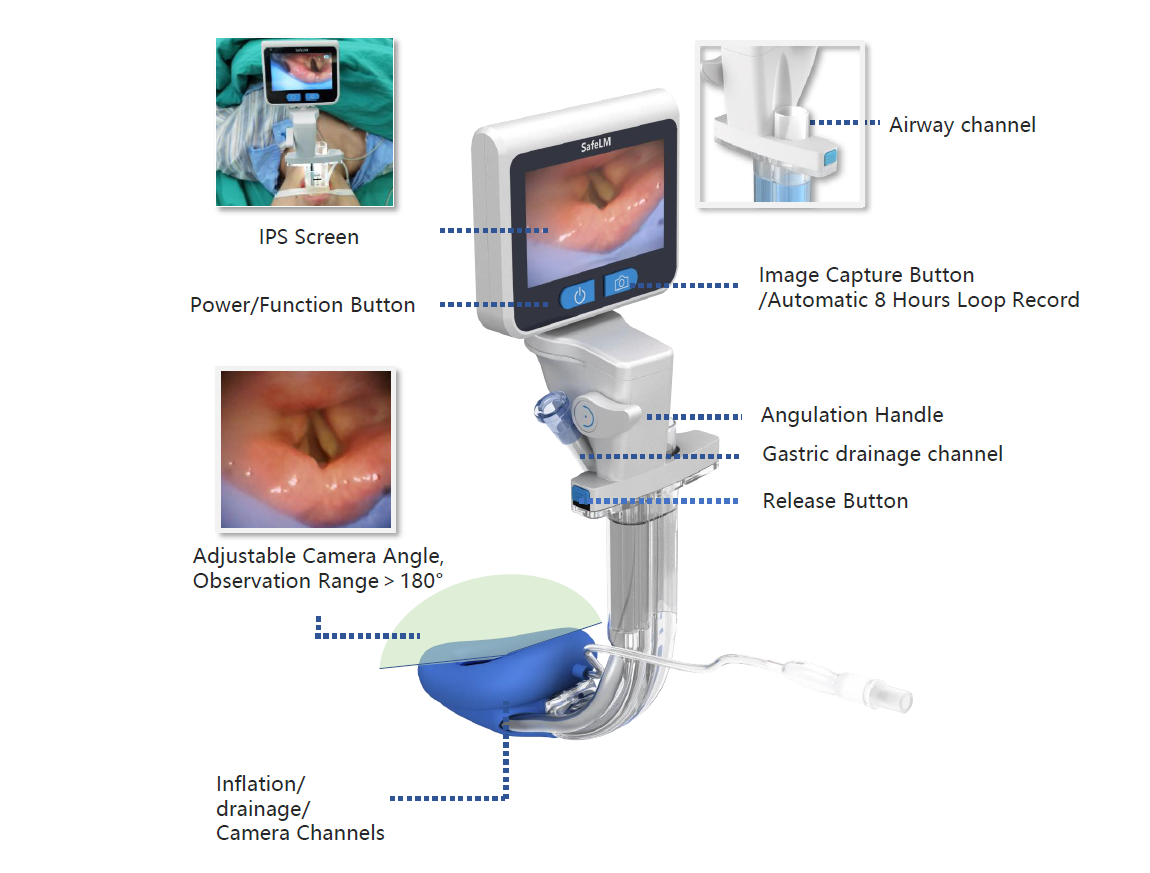 Magill Medical Video Laryngeal Mask (VLMA) Laryngeal Mask Airways and